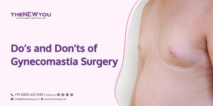 Do’s and Don’ts Before Your Gynecomastia Surgery